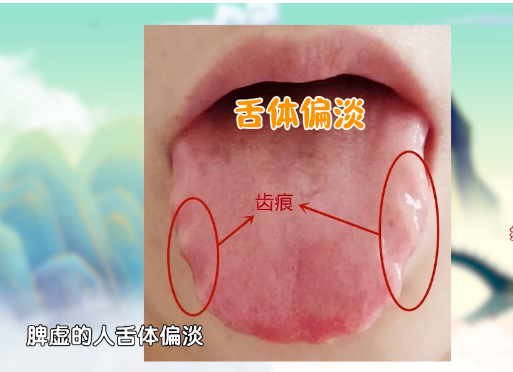 手上一個(gè)部位，看出你是否有溼氣！按摩一個(gè)穴位，健脾祛溼
