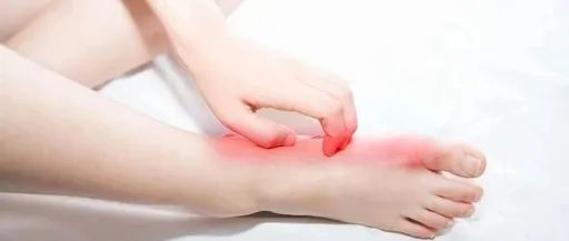 腳氣總是反覆發(fā)作治不好？該如何緩解腳氣？